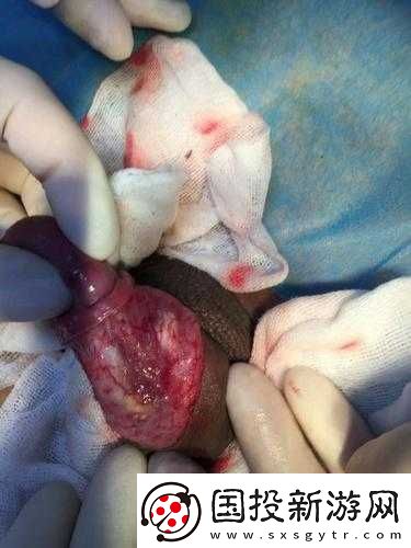 小弟里面有白色的東西怎么清理：實用方法分享